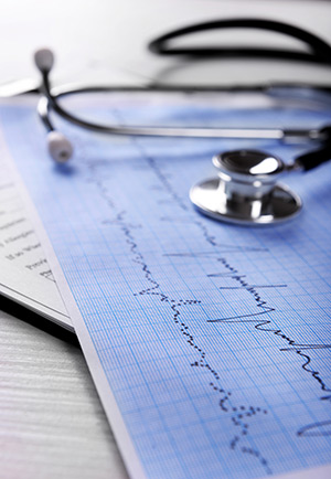 Stethoskop auf einem EKG-Streifen
